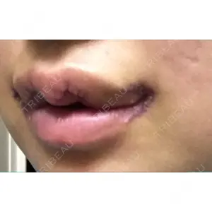 現代美学整形外科口コミ