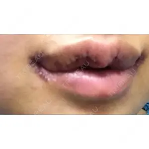 現代美学整形外科口コミ