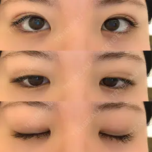 東京イセアクリニック口コミ