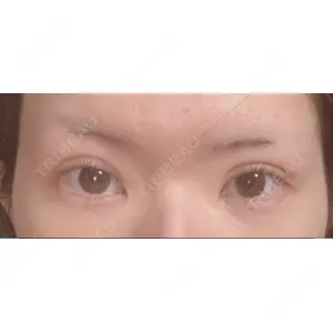 A CLINIC（エークリニック） A CLINIC（エークリニック） 銀座院口コミ