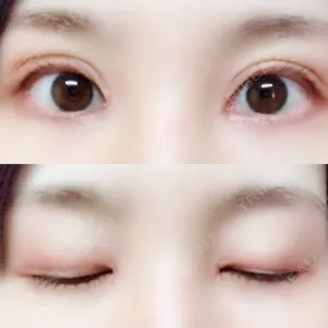 口コミ