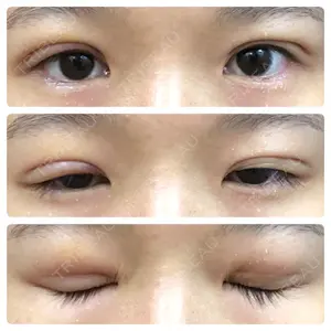 東京BELLEZZAクリニック口コミ