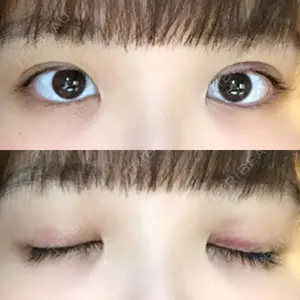 口コミ
