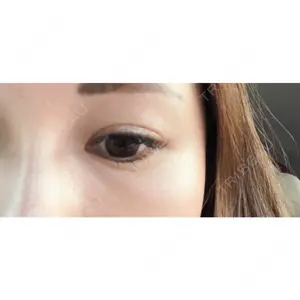 プルージュ美容クリニックの口コミ