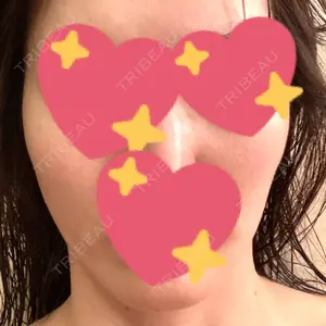 TCB東京中央美容外科 TCB東京中央美容外科 心斎橋院口コミ