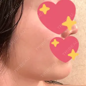TCB東京中央美容外科 TCB東京中央美容外科 心斎橋院口コミ