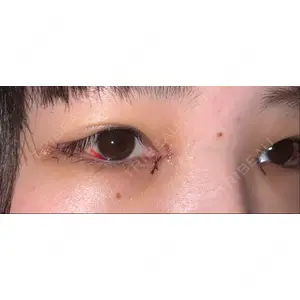 湘南美容クリニック 湘南美容クリニック 池袋東口院口コミ