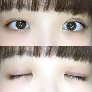 口コミ