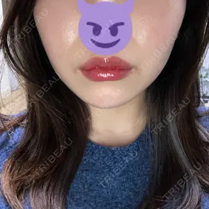 TCB東京中央美容外科 TCB東京中央美容外科 新宿東口院口コミ