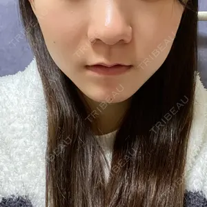 口コミ