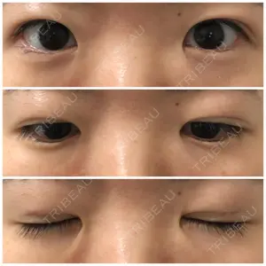東京イセアクリニック口コミ