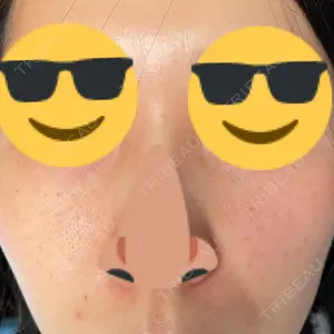 南青山TOKUNAKAクリニック口コミ