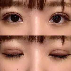 TCB東京中央美容外科 TCB東京中央美容外科 新宿三丁目院口コミ