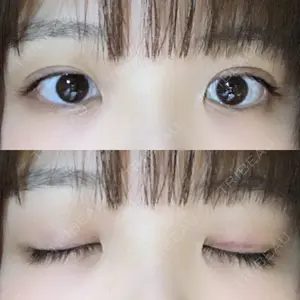 口コミ