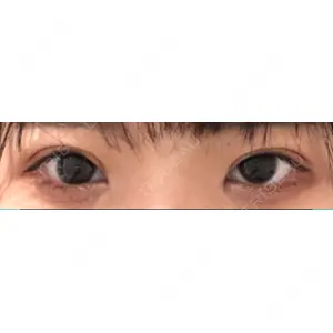 口コミ
