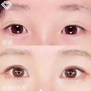 TCB東京中央美容外科 TCB東京中央美容外科 渋谷東口院口コミ
