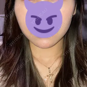 TCB東京中央美容外科 TCB東京中央美容外科 新宿東口院口コミ