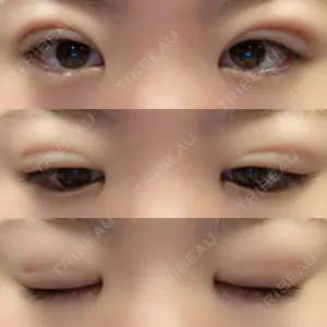 東京イセアクリニック口コミ