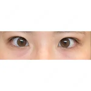 口コミ