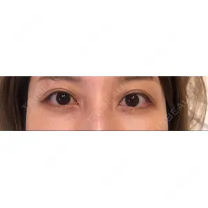 APOLLO BEAUTY CLINIC口コミ
