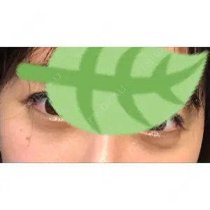 韓国ST美容整形外科口コミ