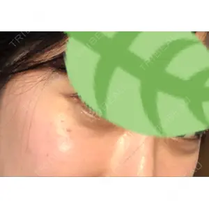 韓国ST美容整形外科口コミ