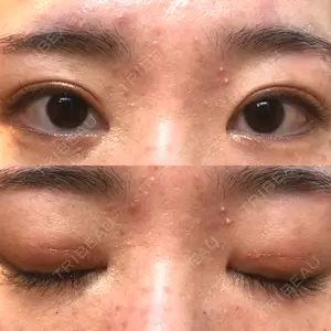 いちのせ形成外科・皮膚科 眼瞼＆フェイスクリニック口コミ