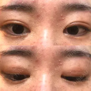 いちのせ形成外科・皮膚科 眼瞼＆フェイスクリニック口コミ