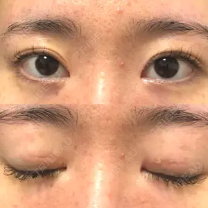 いちのせ形成外科・皮膚科 眼瞼＆フェイスクリニック口コミ
