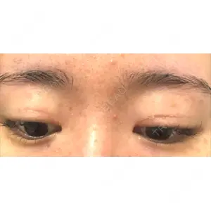 いちのせ形成外科・皮膚科 眼瞼＆フェイスクリニック口コミ