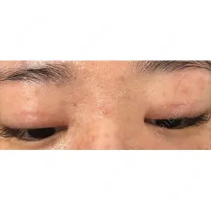 いちのせ形成外科・皮膚科 眼瞼＆フェイスクリニック口コミ