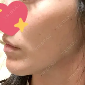 TCB東京中央美容外科 TCB東京中央美容外科 心斎橋院口コミ