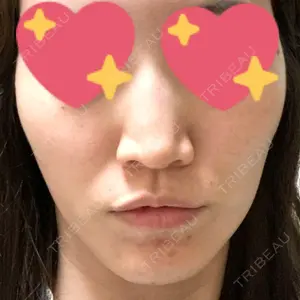 TCB東京中央美容外科 TCB東京中央美容外科 心斎橋院口コミ