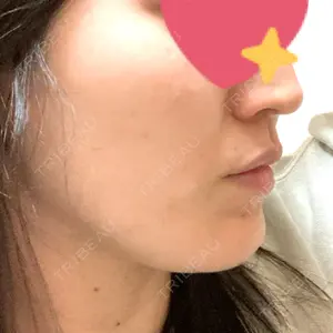 TCB東京中央美容外科 TCB東京中央美容外科 心斎橋院口コミ