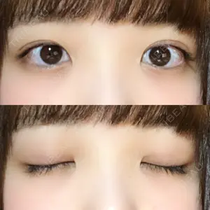 口コミ
