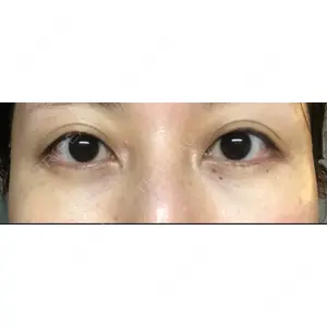 APOLLO BEAUTY CLINIC口コミ