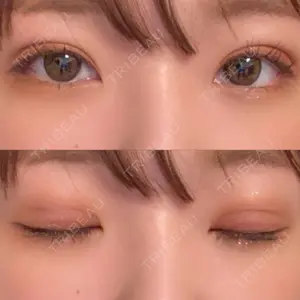 TCB東京中央美容外科 TCB東京中央美容外科 新宿三丁目院口コミ