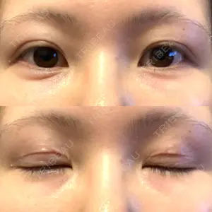 口コミ