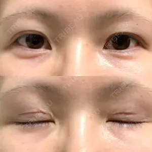 口コミ