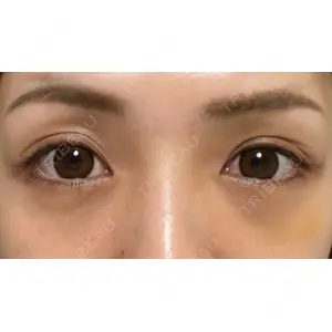 APOLLO BEAUTY CLINIC口コミ