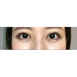 APOLLO BEAUTY CLINIC口コミ