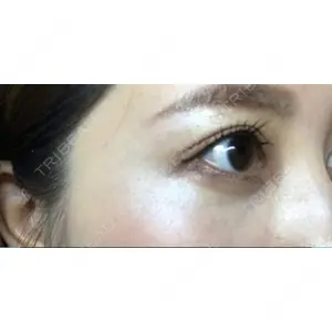 APOLLO BEAUTY CLINIC口コミ