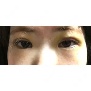 口コミ