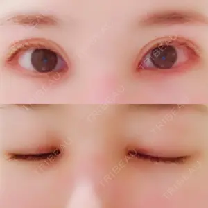 口コミ