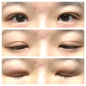 東京BELLEZZAクリニック口コミ