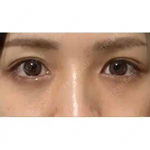 APOLLO BEAUTY CLINIC口コミ