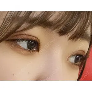 TCB東京中央美容外科 TCB東京中央美容外科 新宿三丁目院口コミ