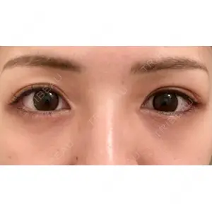 APOLLO BEAUTY CLINIC口コミ
