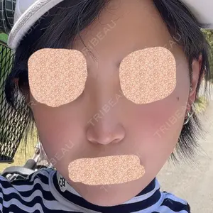 リッツ美容外科 大阪院口コミ