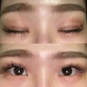 A CLINIC（エークリニック） A CLINIC（エークリニック） 銀座院口コミ
